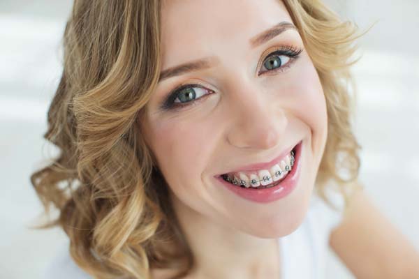 adult orthodontic options