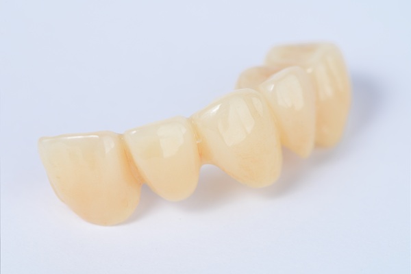 How To Tell If You Are A Candidate For A Dental Bridge