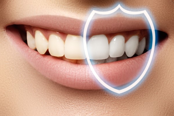 Questions To Ask Your Dentist About Teeth Whitening