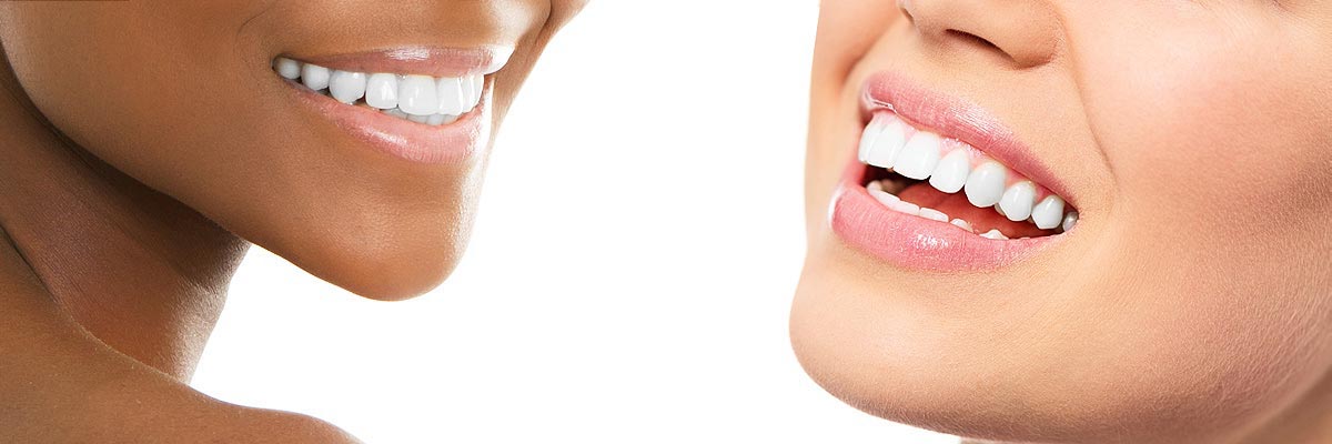 Dalton Teeth Whitening