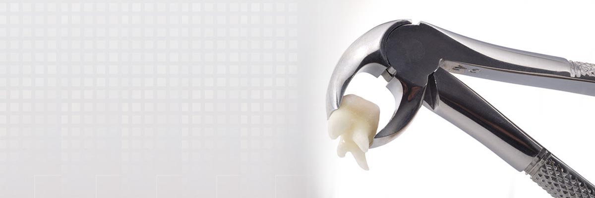 Dalton Tooth Extraction