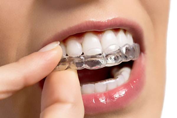 ways to relieve invisalign pain